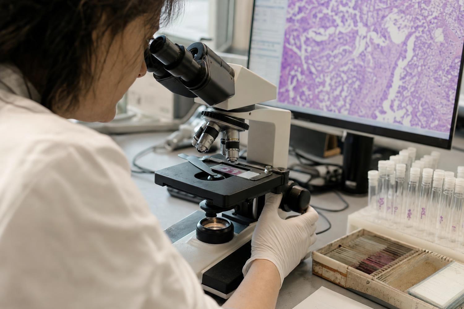 Più noduli ai polmoni? Quel legame con il DNA che non ti aspetti