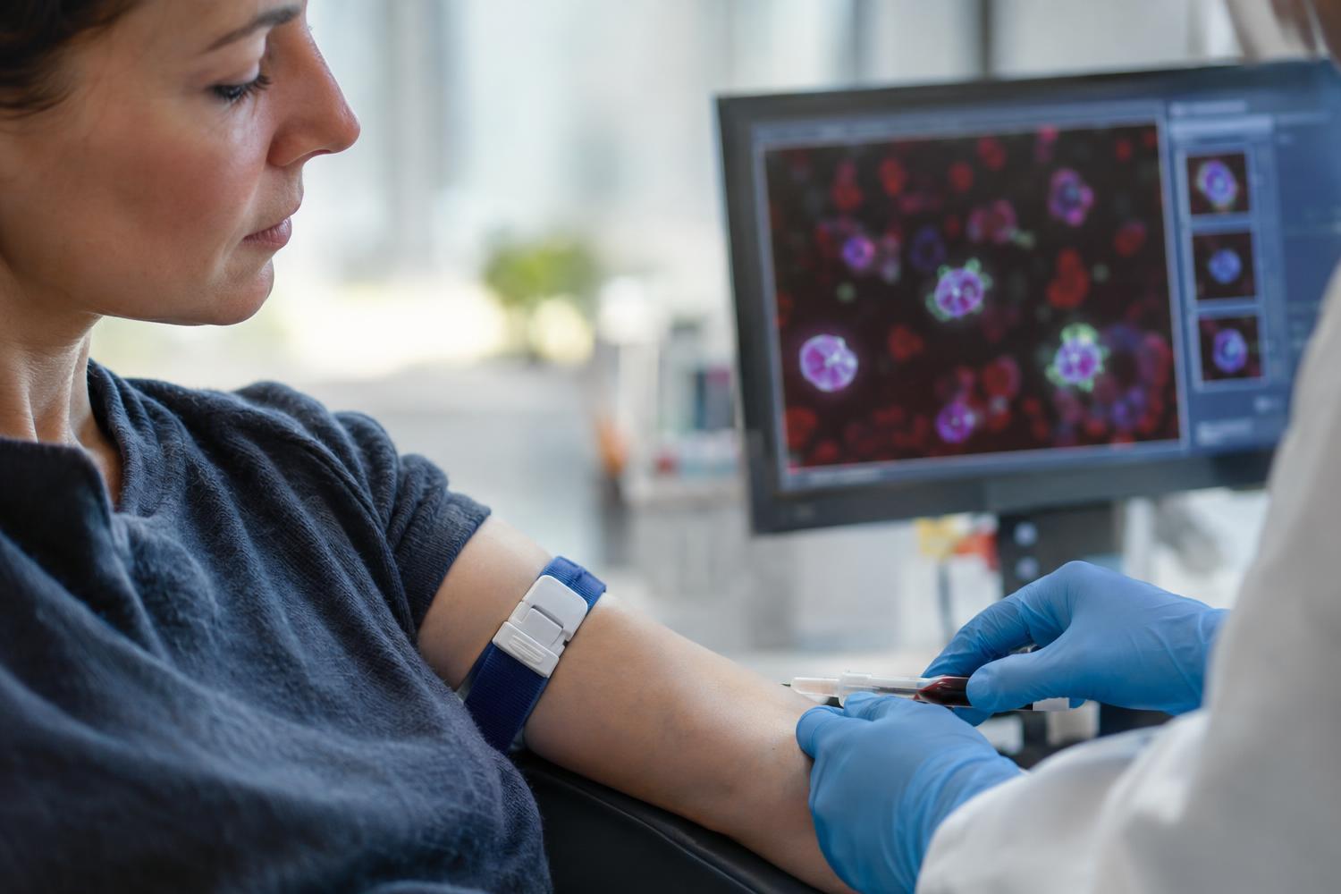 Tumori: la novità nel sangue che potrebbe rivoluzionare i controlli