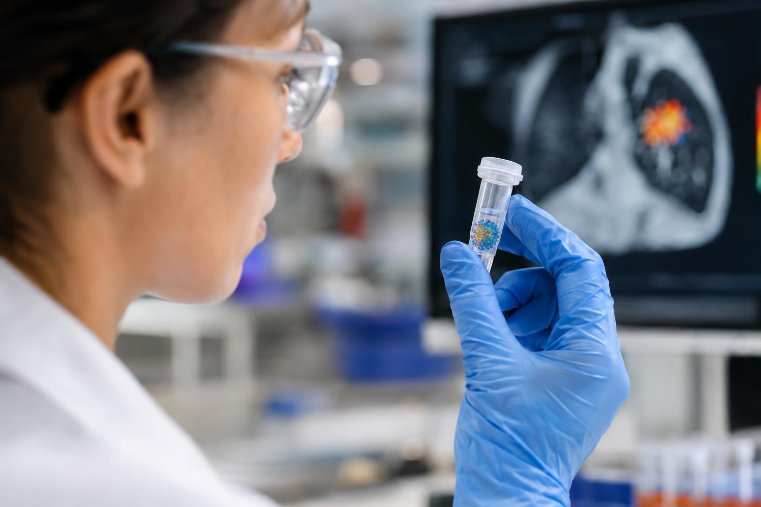 Tumore al polmone: e se l’mRNA potesse scovare solo le cellule malate?