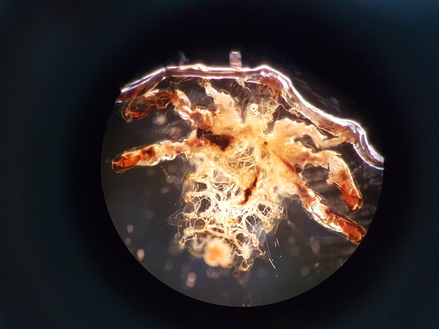 Piattola al microscopio