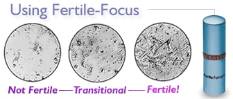 Saliva a forma di felce Fotografie di come appare la saliva femminile osservata a microscopio