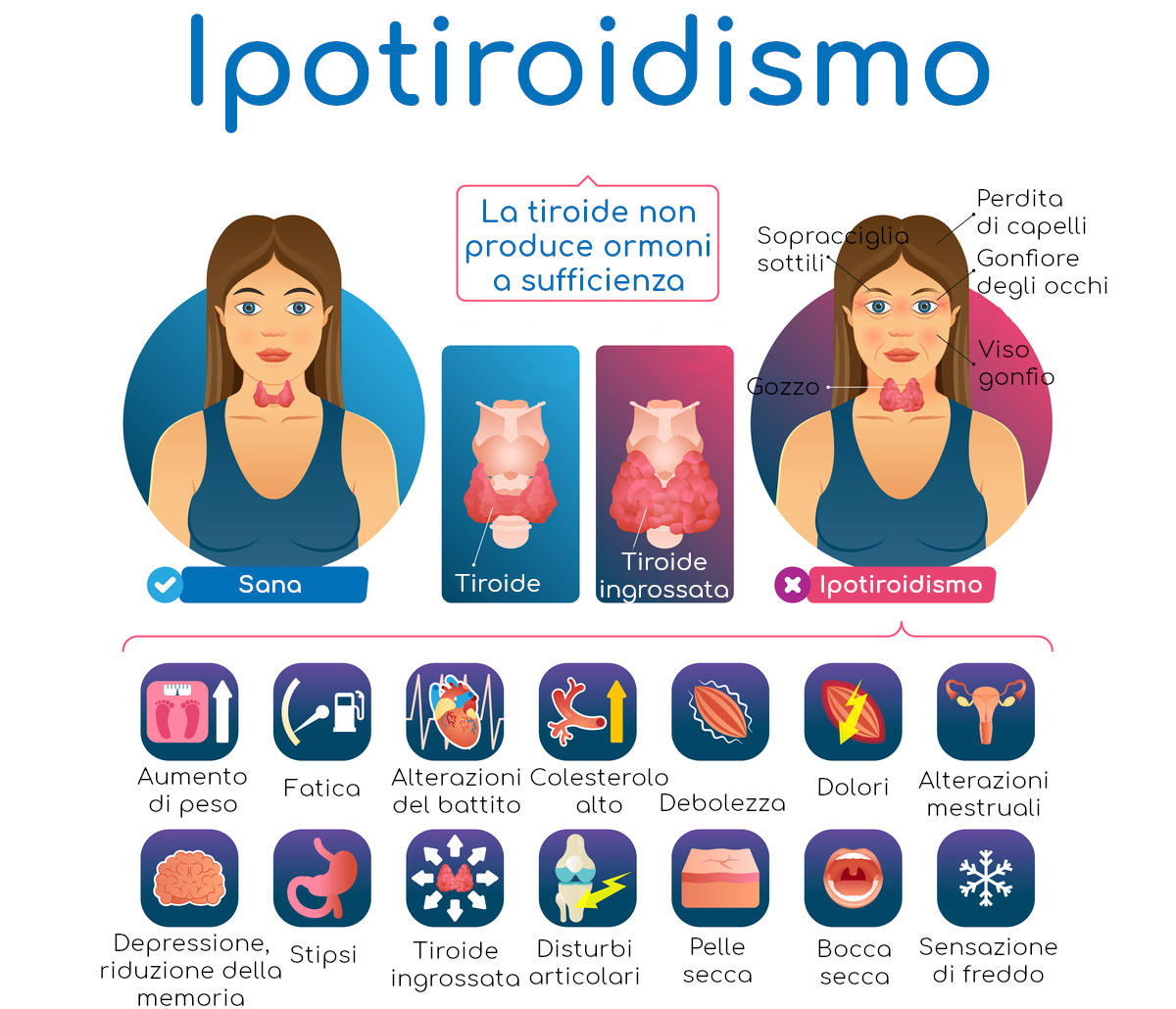 Infografica riassuntiva sull'ipotiroidismo e sui suoi sintomi