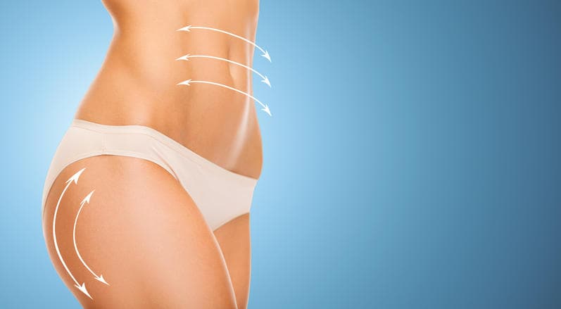 Fotografia di una modella in cui sono evidenziati addome e cosce, zone obiettivo della liposuzione