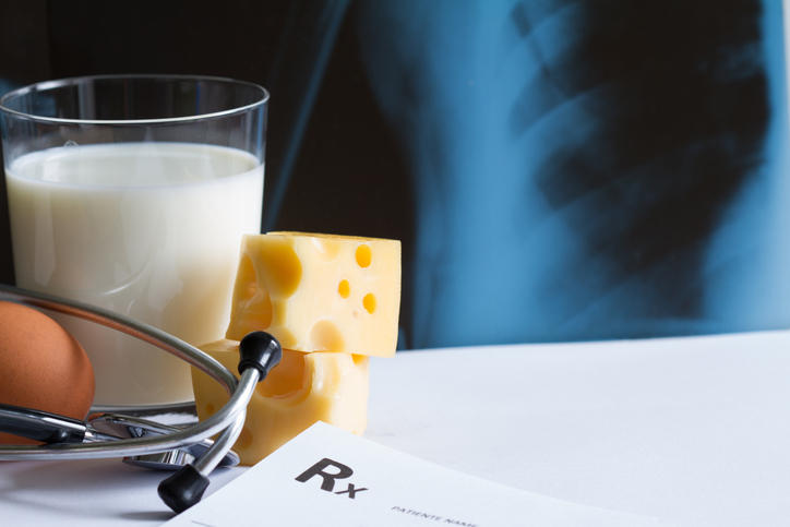 Fotografia con un bicchiere di latte, formaggio e sullo sfondo una radiografia
