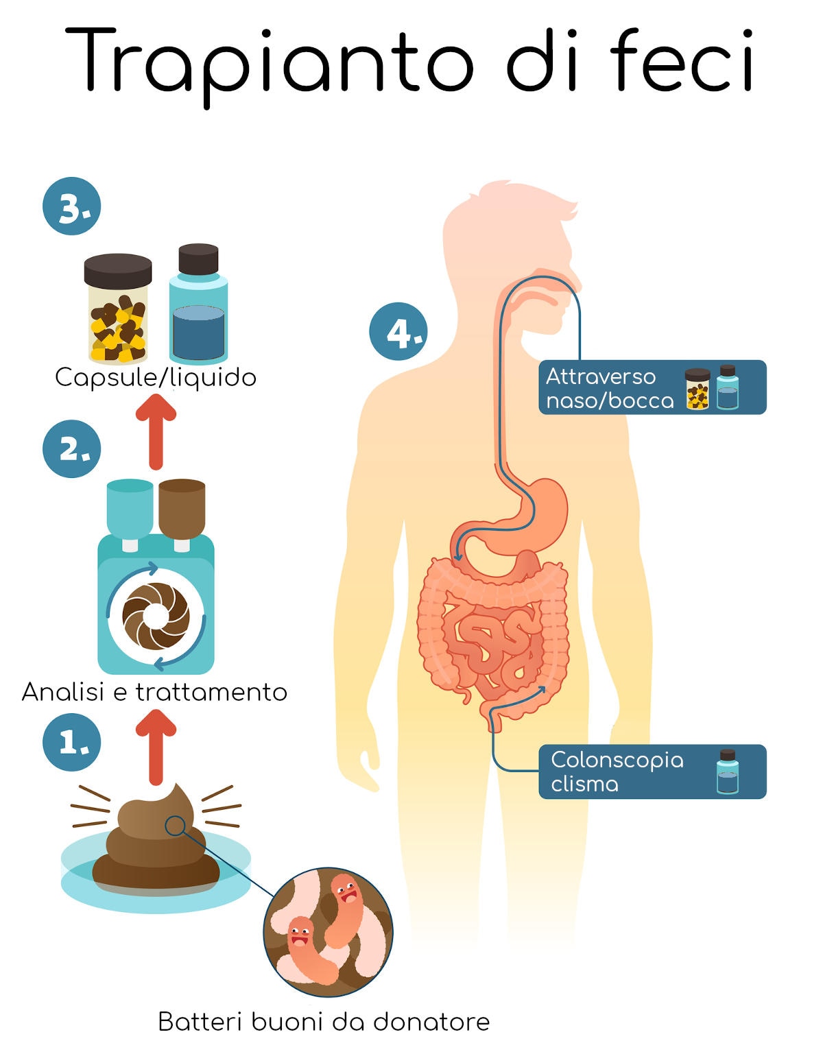 Infografica semplificata sul trapianto di feci