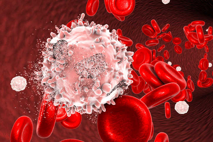 Rappresentazione grafica della distruzione cellulare causata dalla leucemia