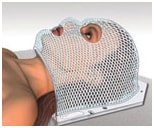 Maschera per la radioterapia