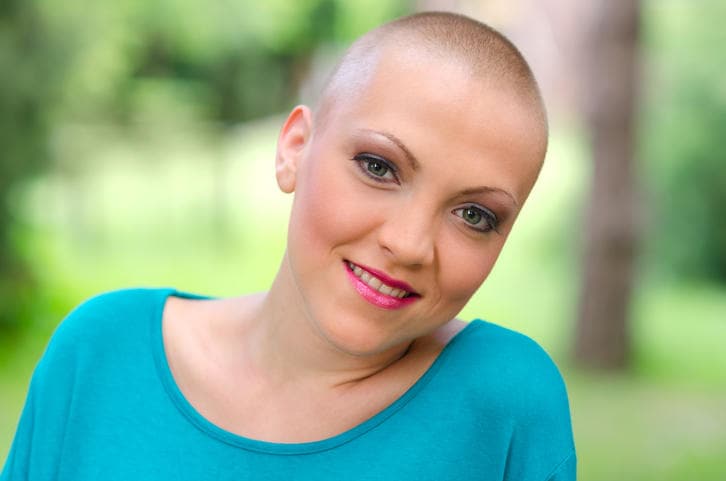 Giovane donna guarita dal tumore, che sorride nonostante la perdita dei capelli.
