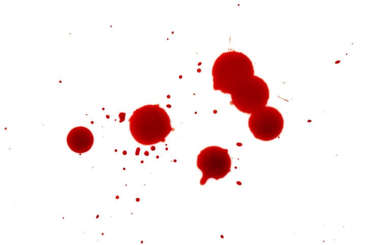 Fotografie di macchie di sangue su sfondo bianco