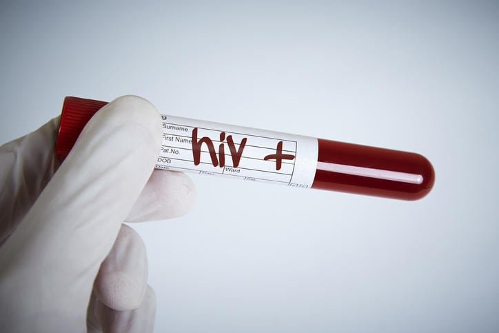 Provetta di sangue con la scritta hiv+