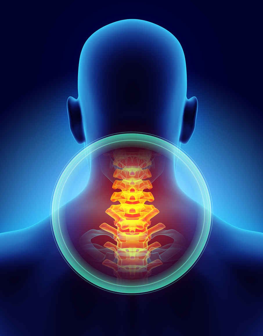 Ricostruzione grafica del tratto cervicale della colonna vertebrale.