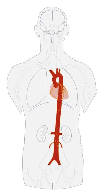 Aorta