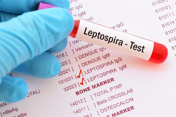Provetta di sangue per il test della leptospirosi