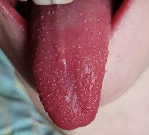 Foto della lingua a fragola