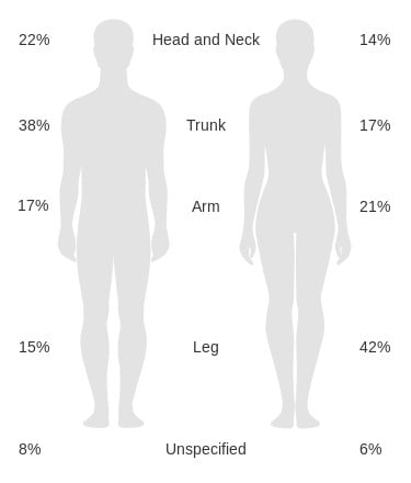 Immagine delle zone a rischio di comparsa di melanoma