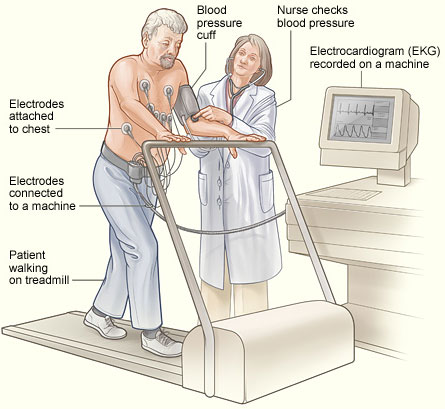 Immagine che rappresenta l'esecuzione di un elettrocardiogramma sotto sforzo