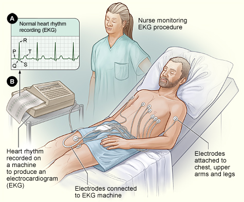 Immagine grafica che mostra l'esecuzione delll'elettrocardiogramma