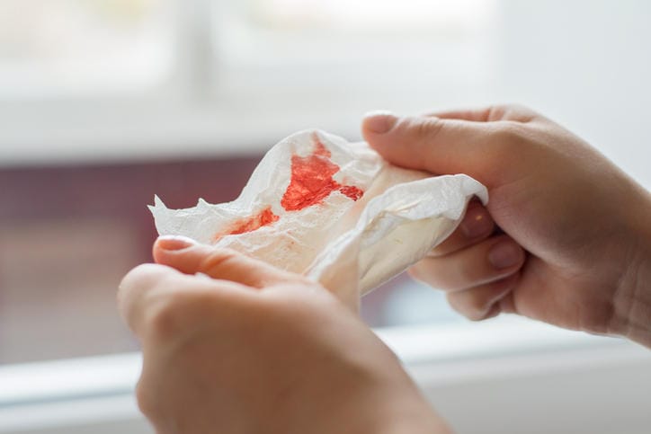 Fazzoletto di carta sporco di sangue