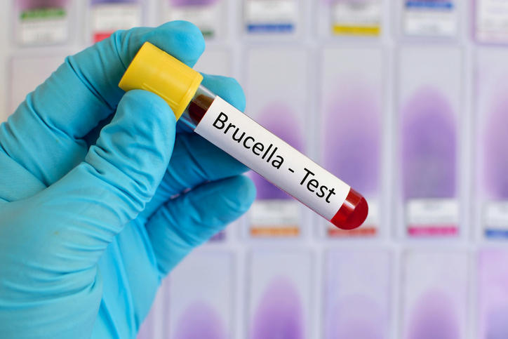 Provetta di sangue per l'esame relativo alla brucellosi