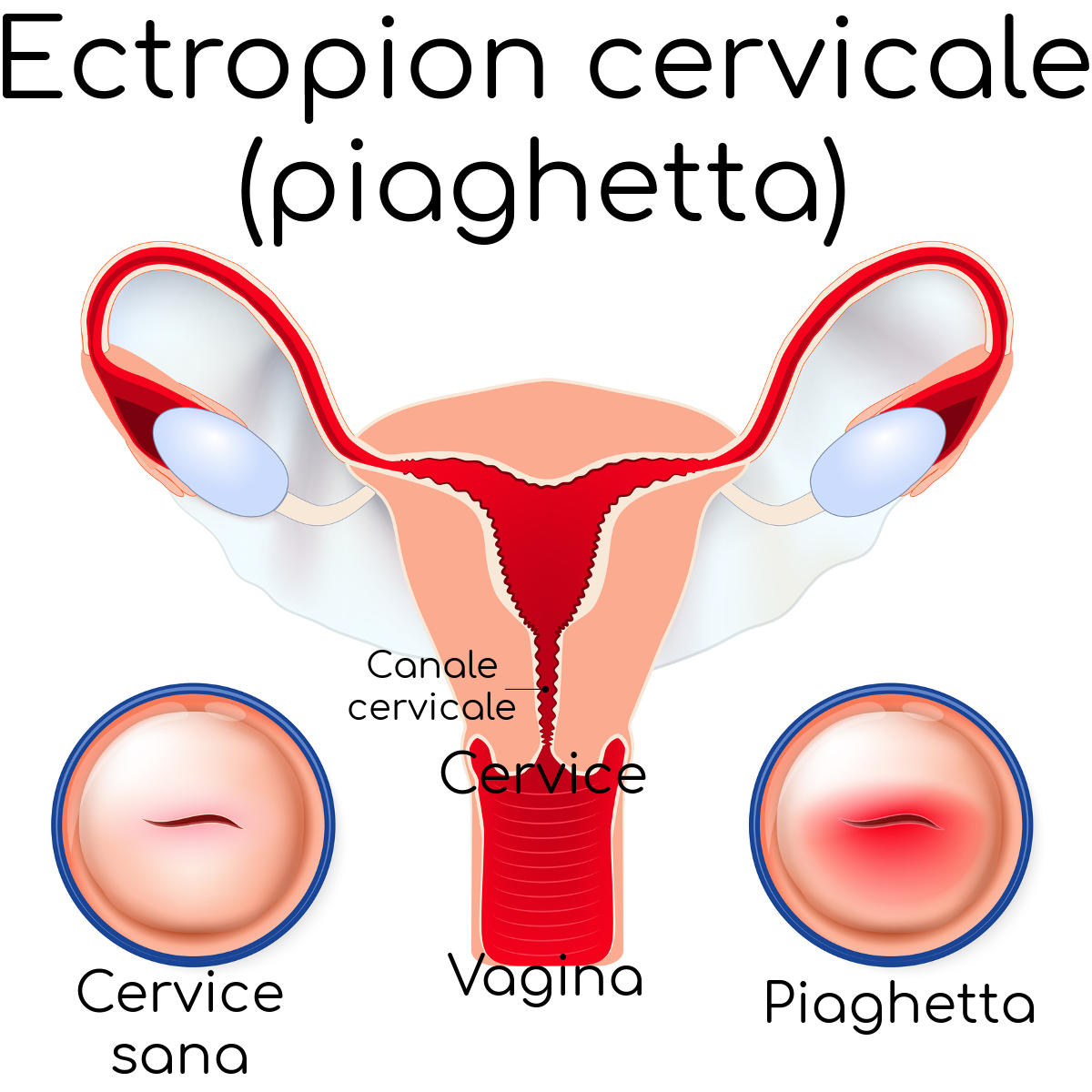 Anatomia semplificata della piaghetta