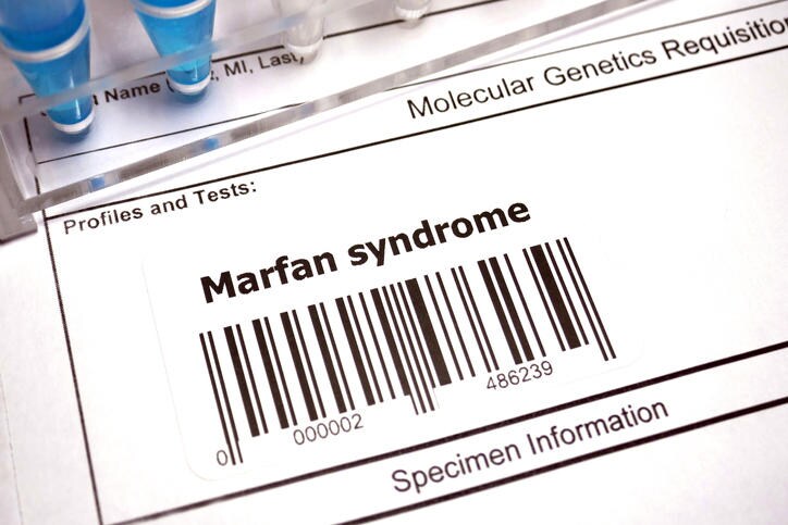 Etichetta per richiesta di esami genetici per la diagnosi della sindrome di Marfan