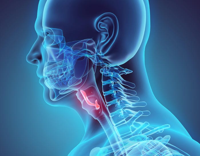 Ricostruzione grafica della posizione anatomica dell'epiglottide