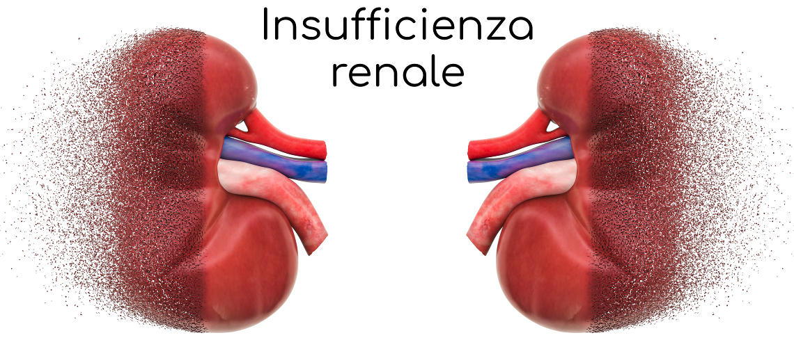Rappresentazione concettuale dell'insufficienza renale, con i reni che si polverizzano