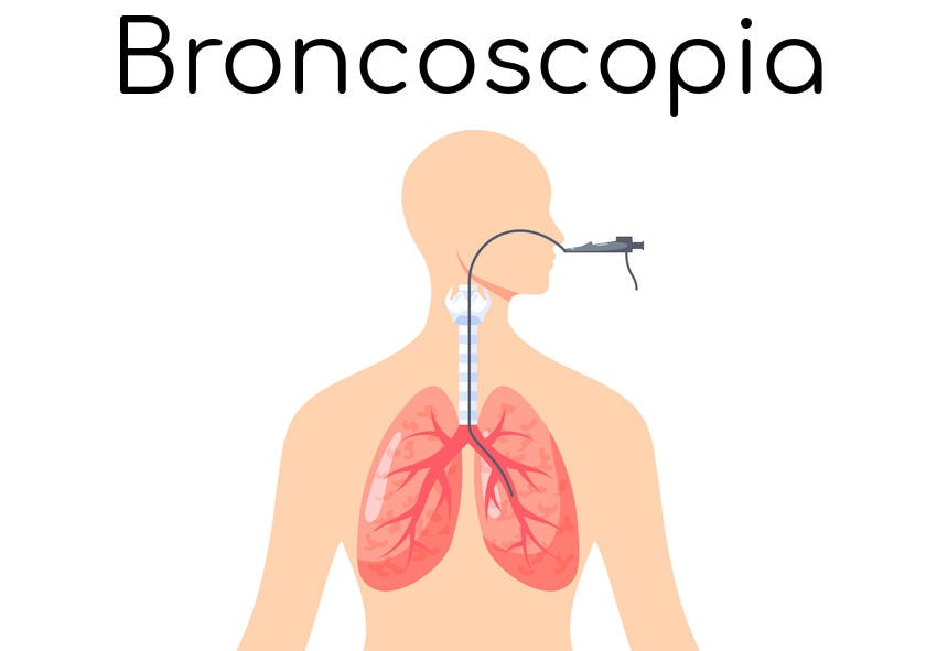 Esemplificazione della broncoscopia