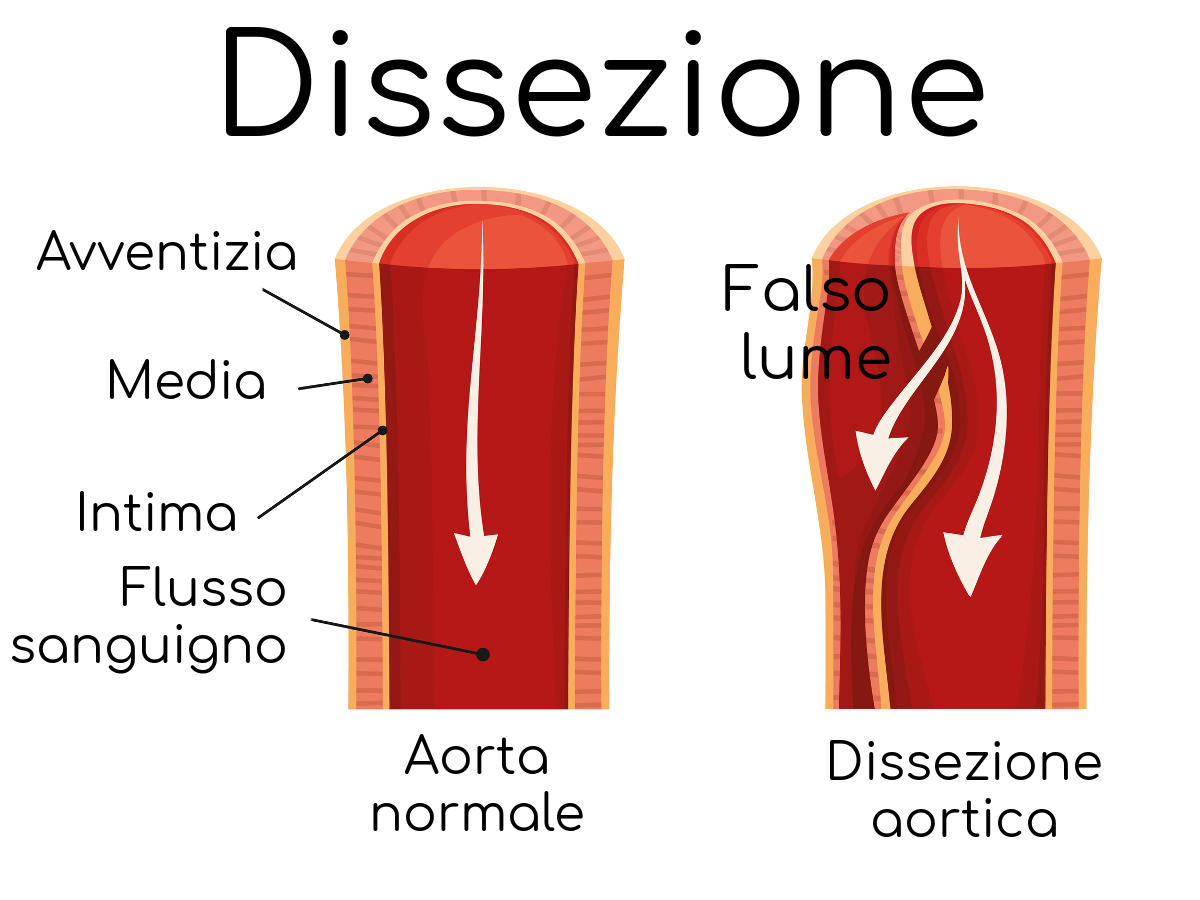 Particolare della dissezione