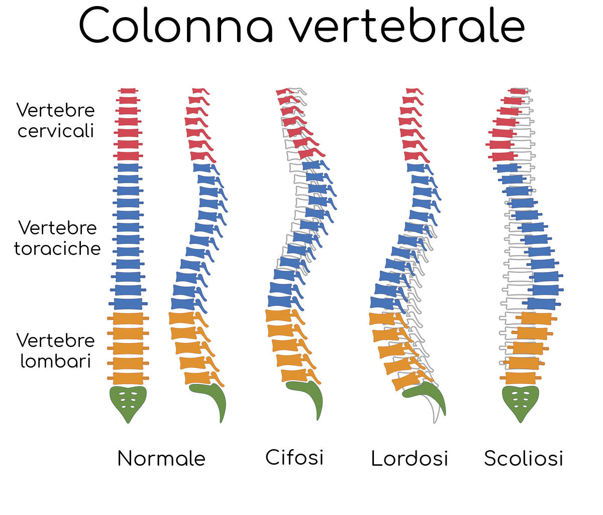 Rappresentazione grafica dei disturbi della colonna vertebrale