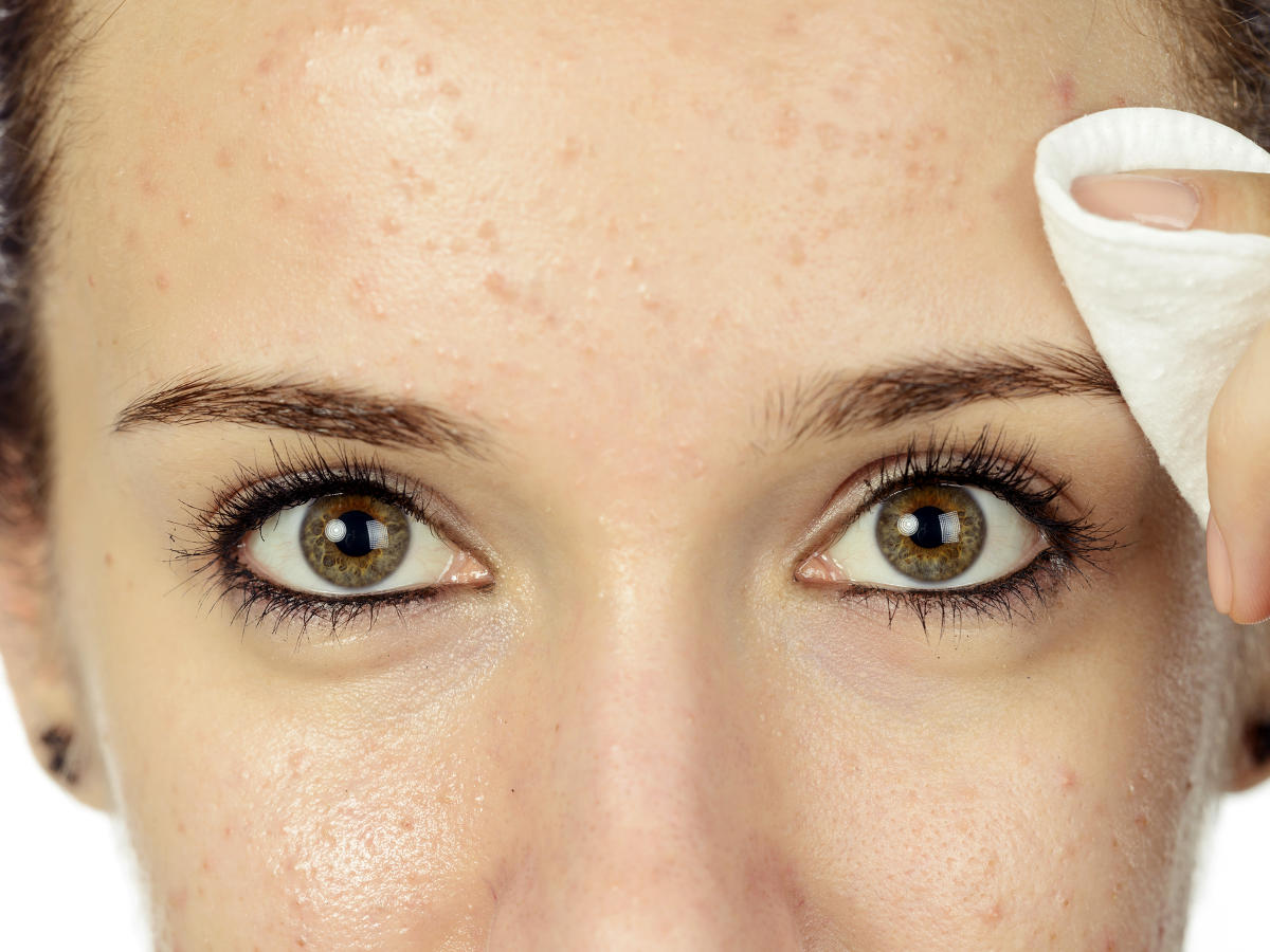 Viso di donna con pelle grassa