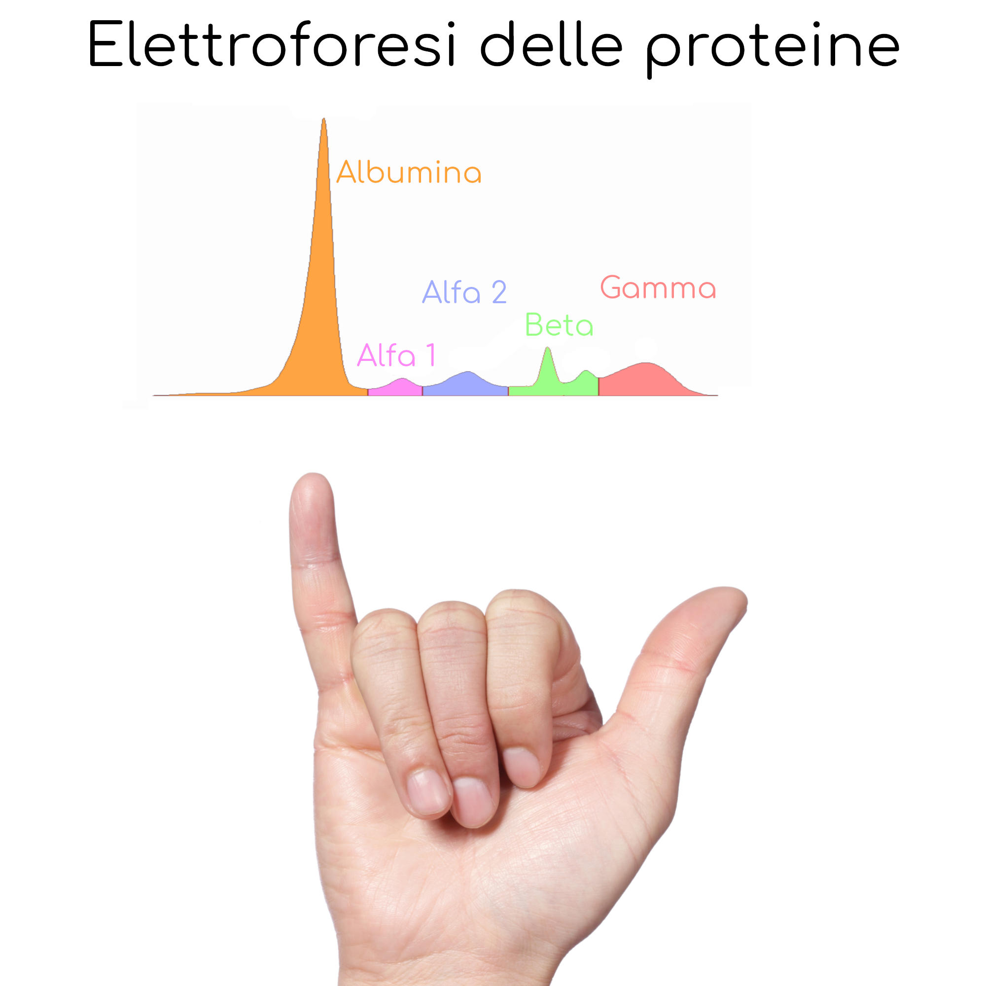 Un piccolo trucco per ricordare l'esito di un'elettroforesi delle proteine normale con la mano