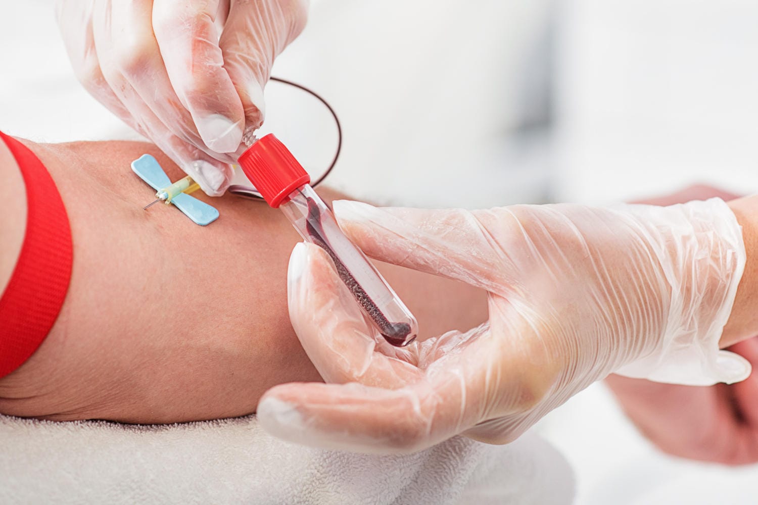 Prelievo di sangue dal braccio