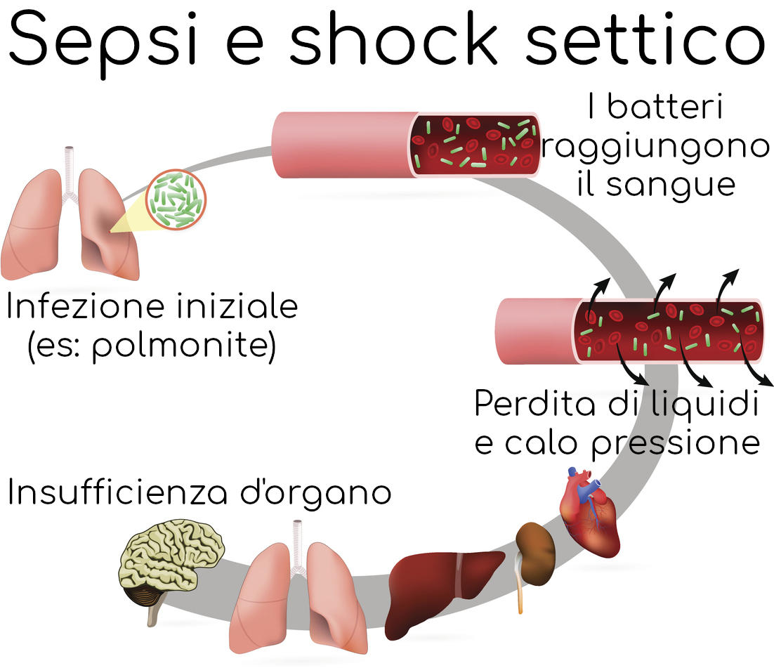 Meccanismo semplificato alla base dello shock settico