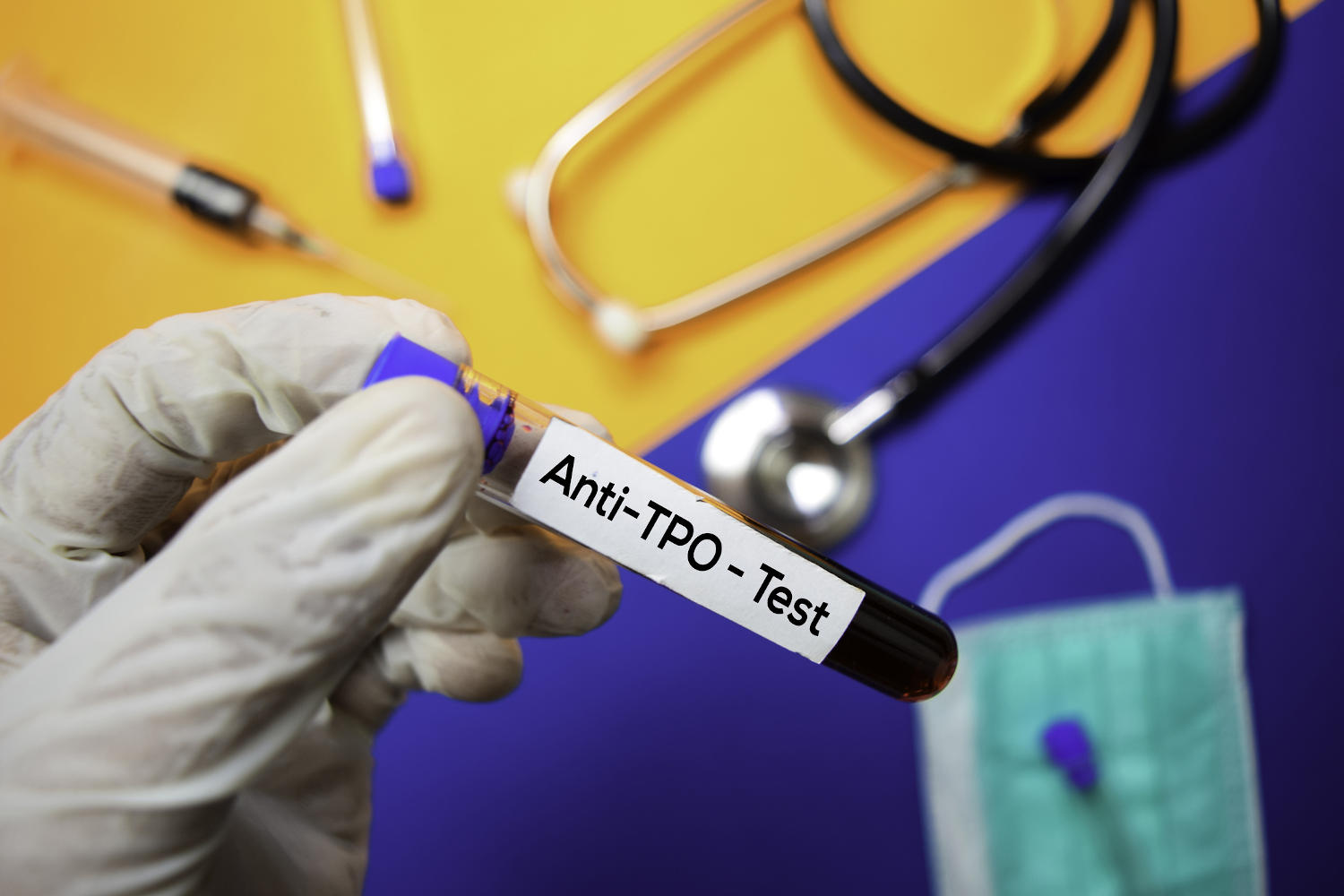 Provetta di sangue con la scritta Anti-TPO Test
