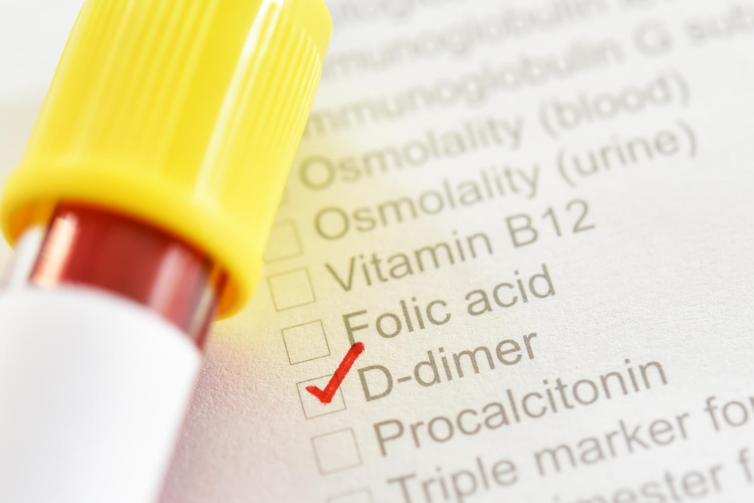 Provetta di sangue accanto ad un foglio di richiesta esami