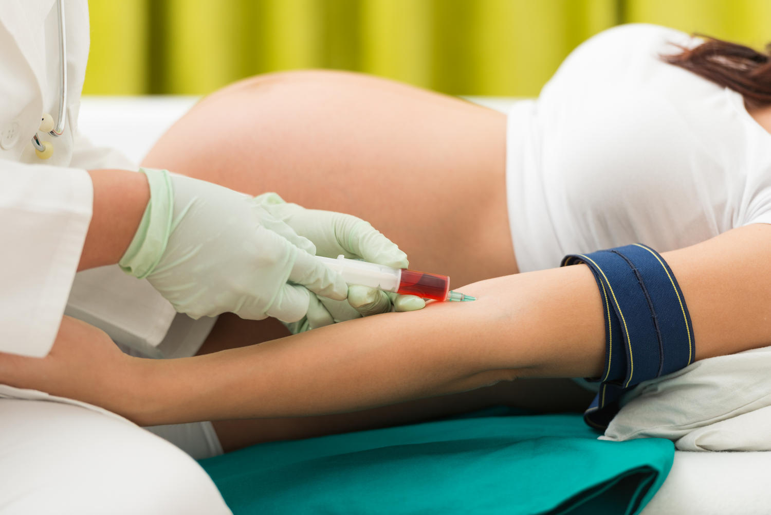 Donna in gravidanza sottoposta ad esame del sangue