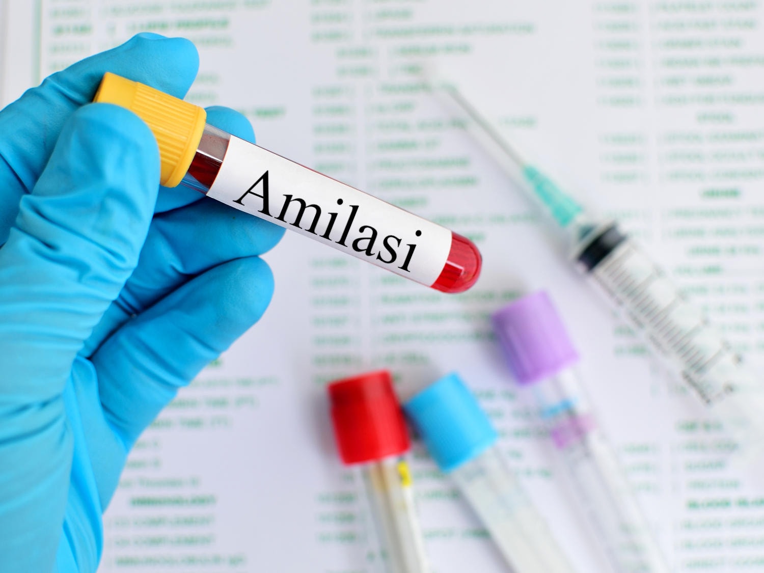 Provetta di sangue con la scritta "amilasi"