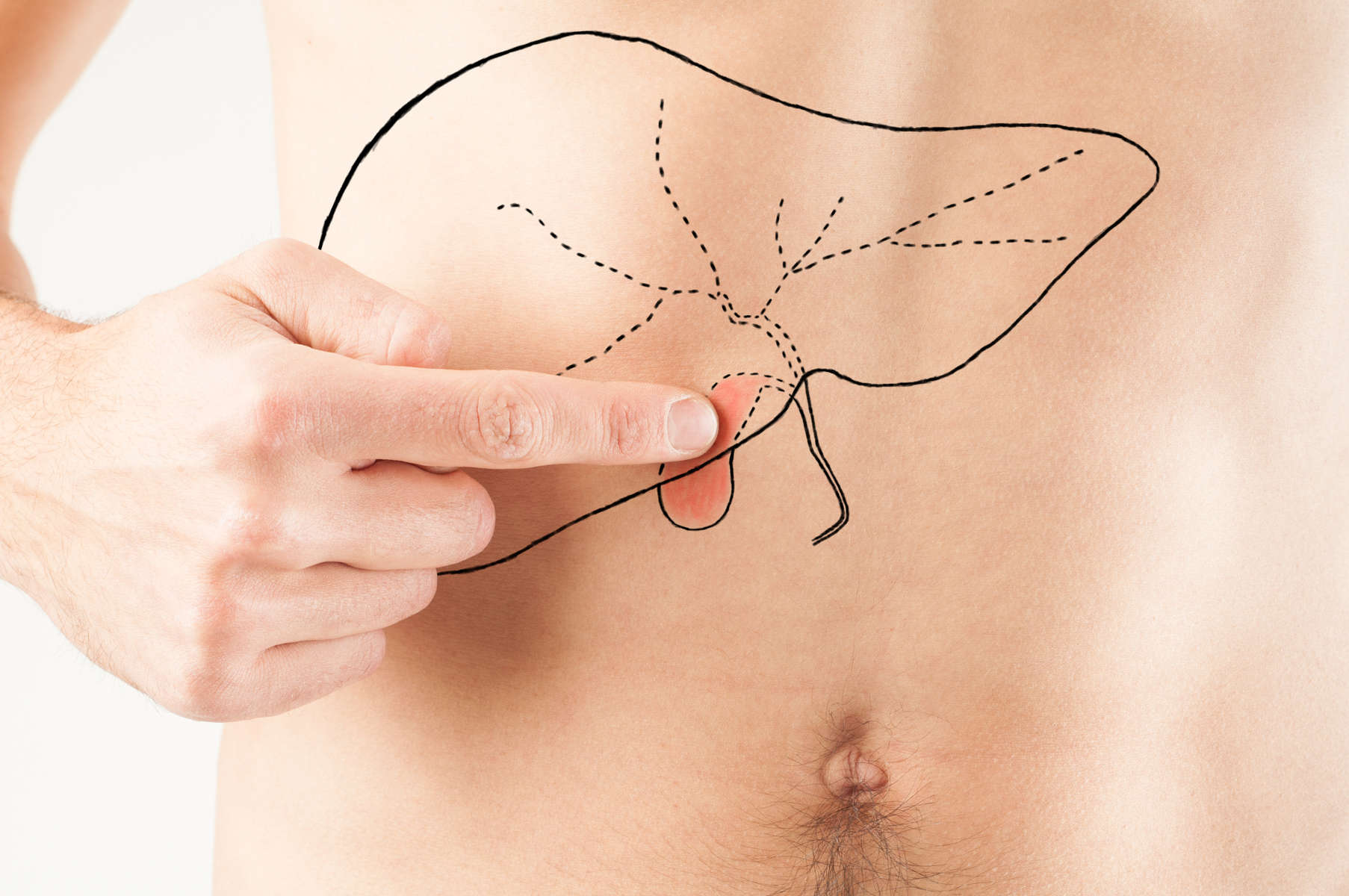 Cistifellea disegnata sulla pancia di un uomo