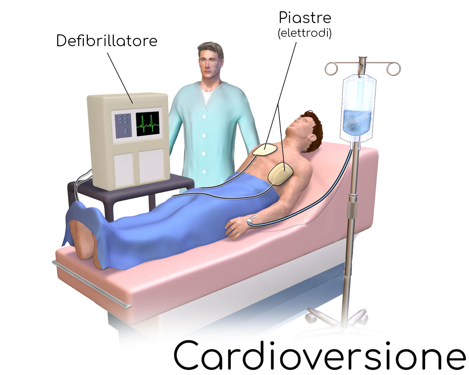 Cardioversione elettrica