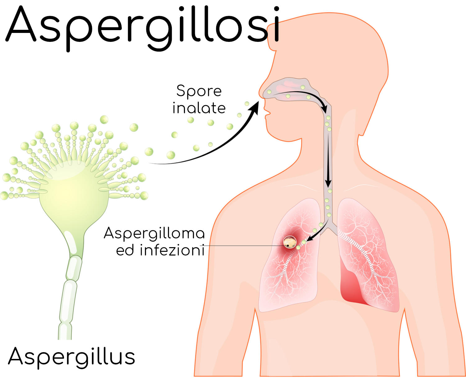 Meccanismo alla base dell'aspergillosi