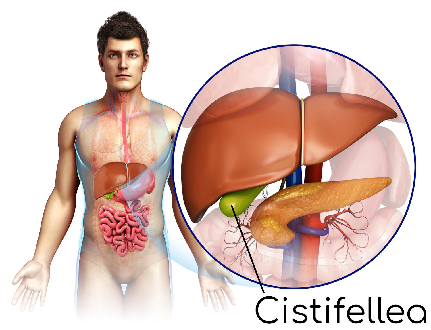 Cistifellea