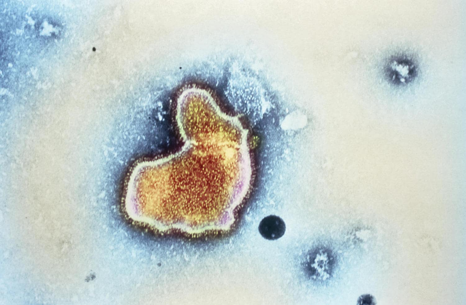 RSV virus
