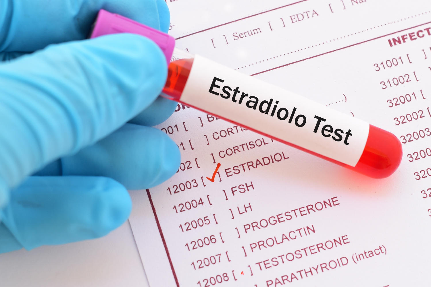 Esame del sangue dell'estradiolo