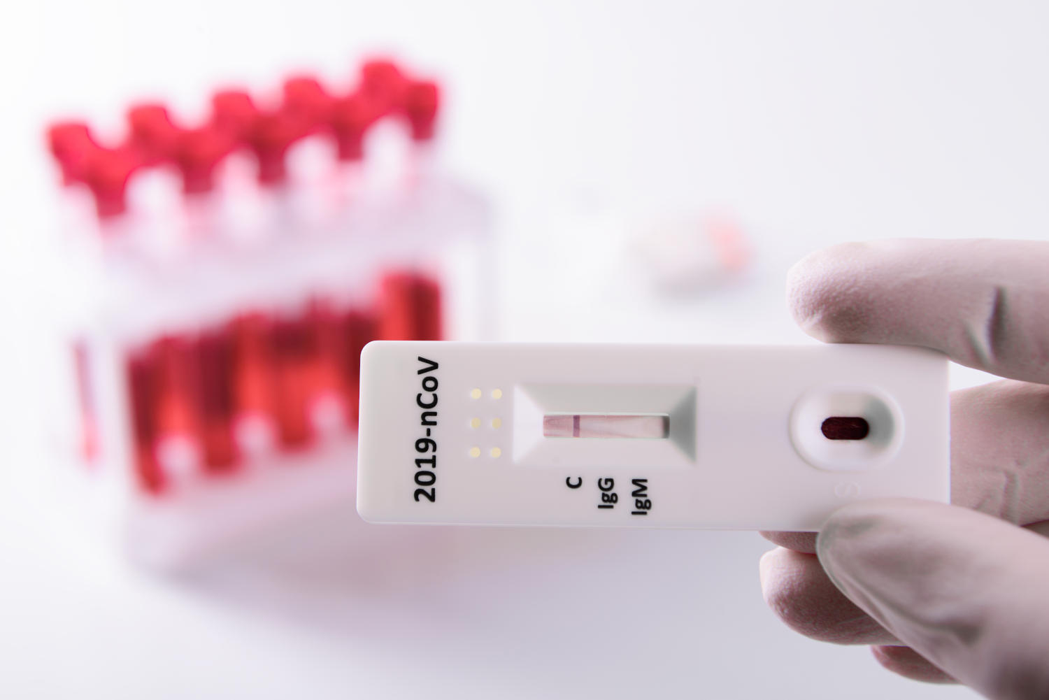 Test rapido sierologico che ricerca gli anticorpi anti-COVID