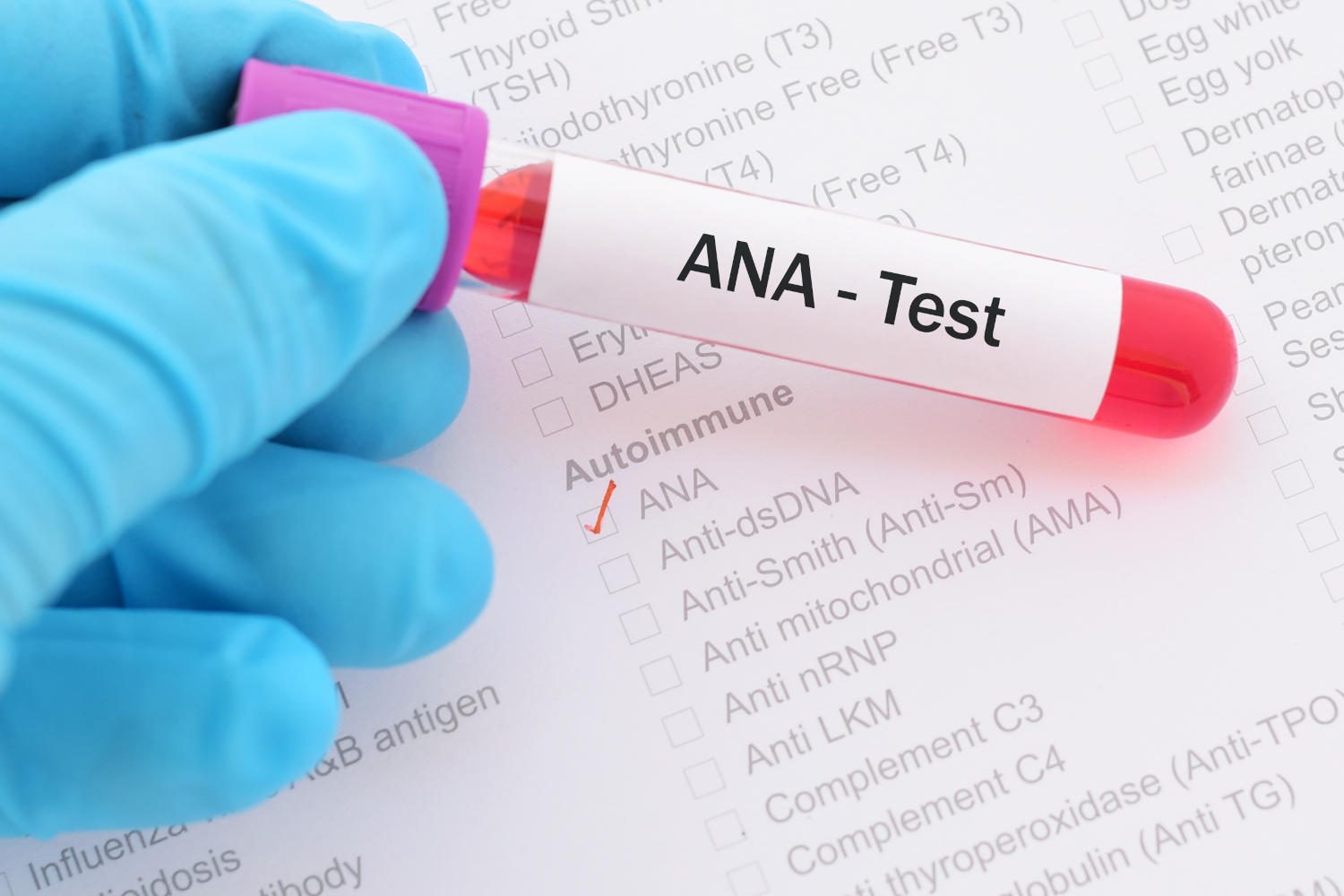 Anticorpi ANA