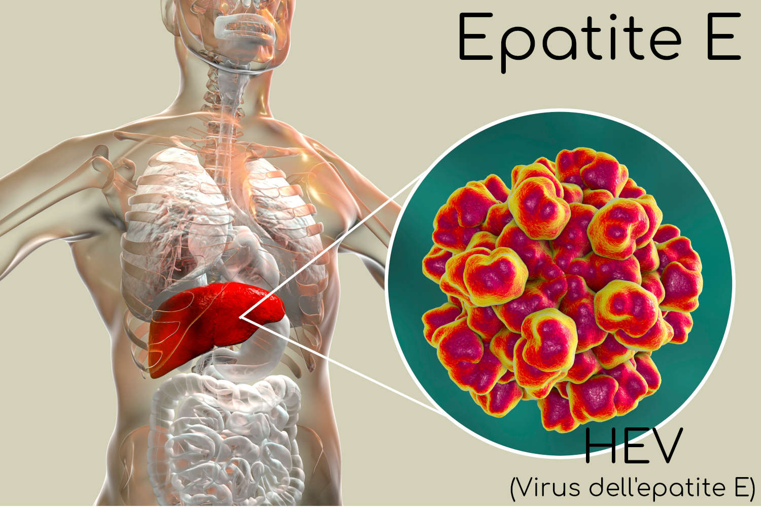 Virus epatite E