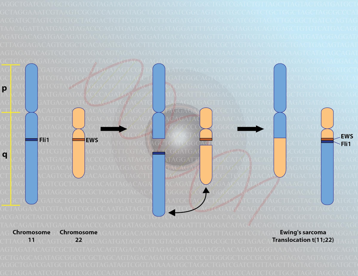 Genetica del sarcoma di Ewing