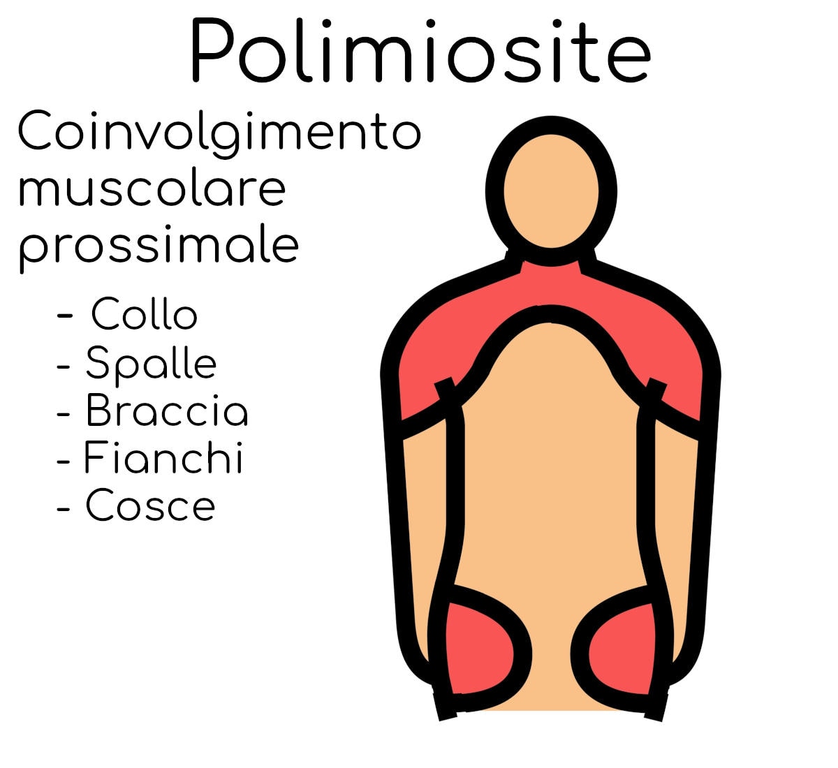 I muscoli coinvolti nella polimiosite