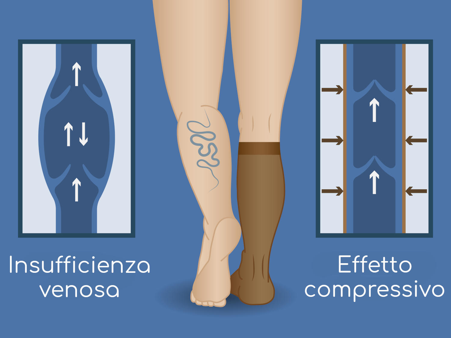 Calze elastiche ed insufficienza venosa